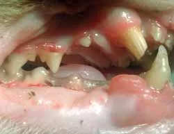 une fracture des dents cause beaucoup de douleur
