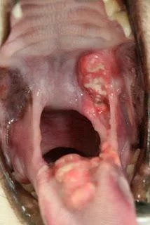 Malattie della bocca gatto